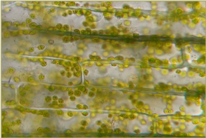 (ENEM 2014 - 3ª Aplicação) Osmose em Célula vegetal.png